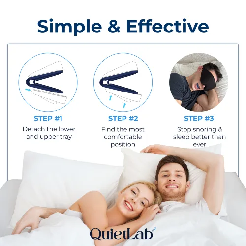 Anti-Snoring Mouthpiece for Better Sleep